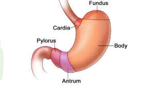 تشخیص آزمایشگاهی سرطان معده در مشهد